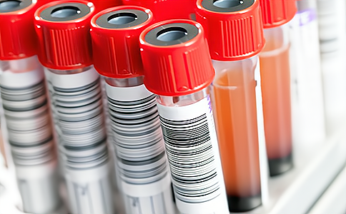 RFID应用于试管试剂管理 RFID应用于试管试剂管理